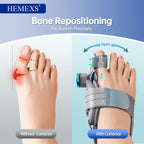Bunion Corrector with Double-Action Relief – Adjustable Toe Straightener for Men & Women